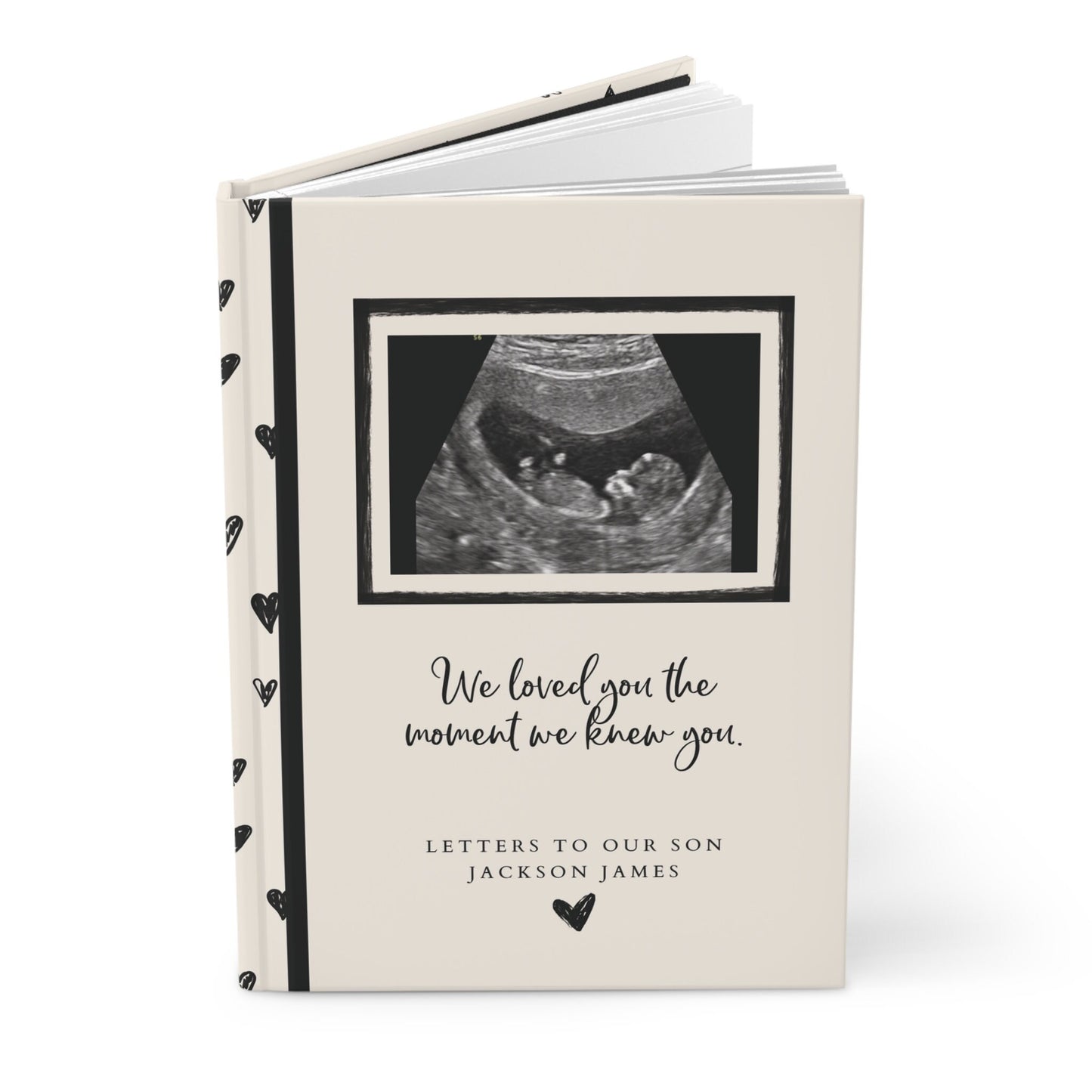 First Sight - A Pregnancy Journal
