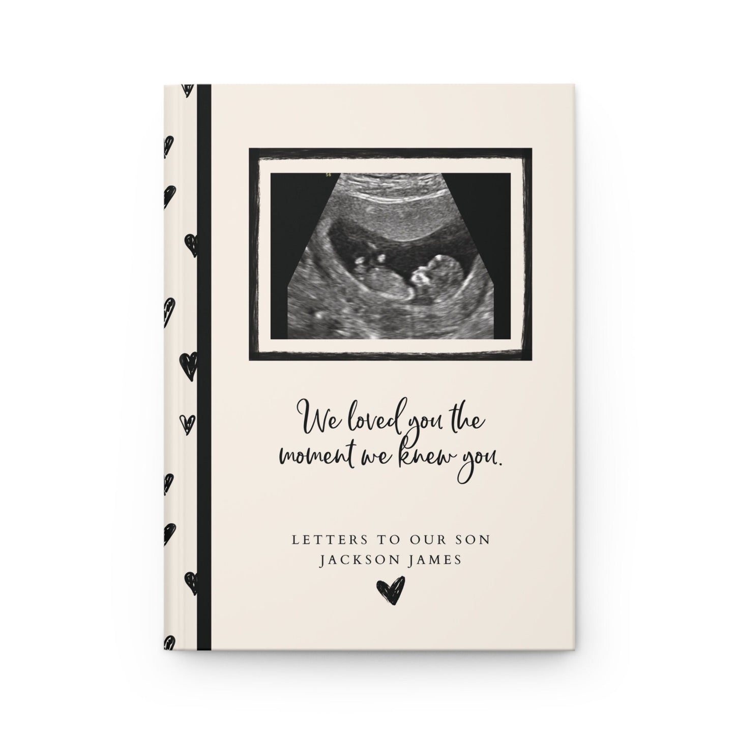 First Sight - A Pregnancy Journal