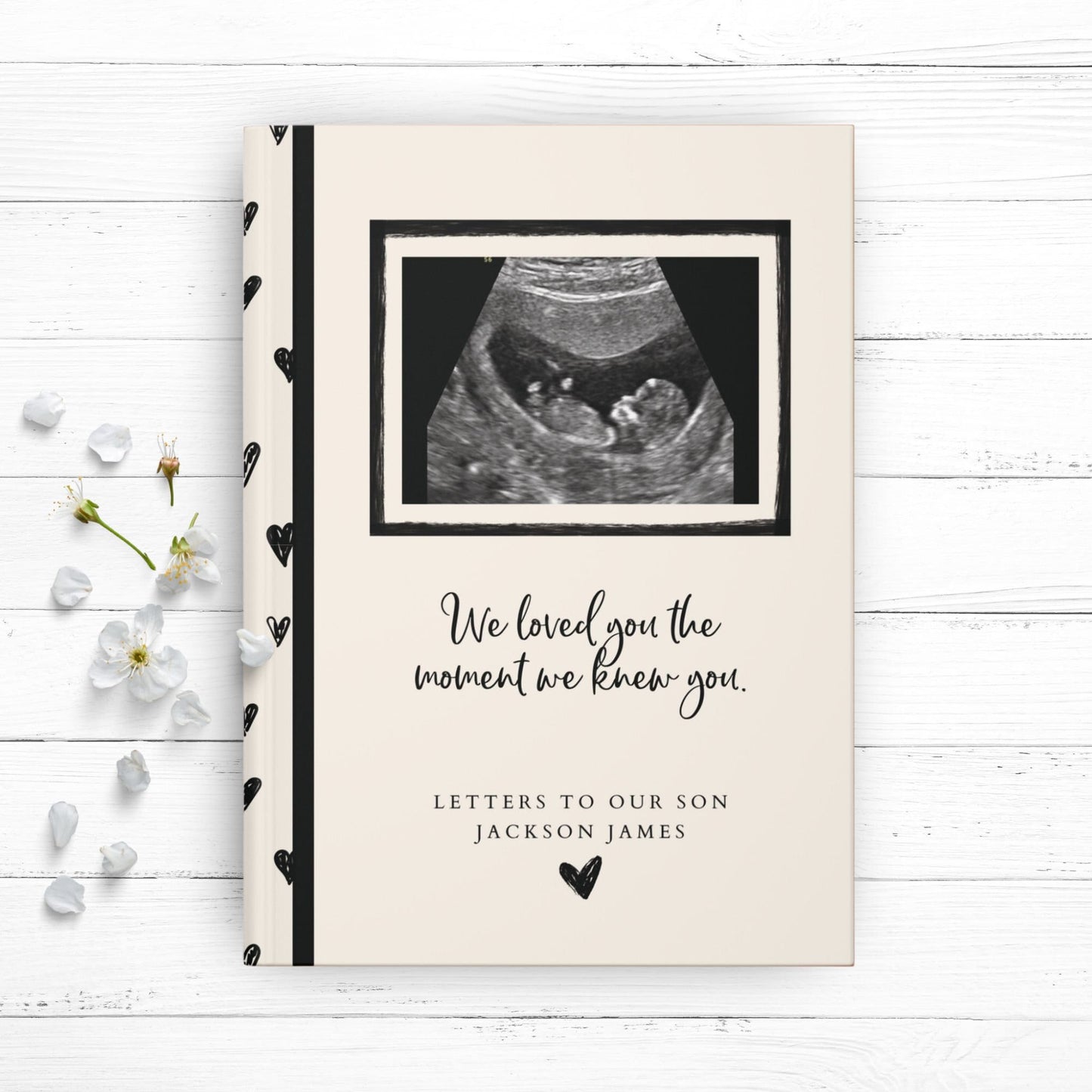 First Sight - A Pregnancy Journal
